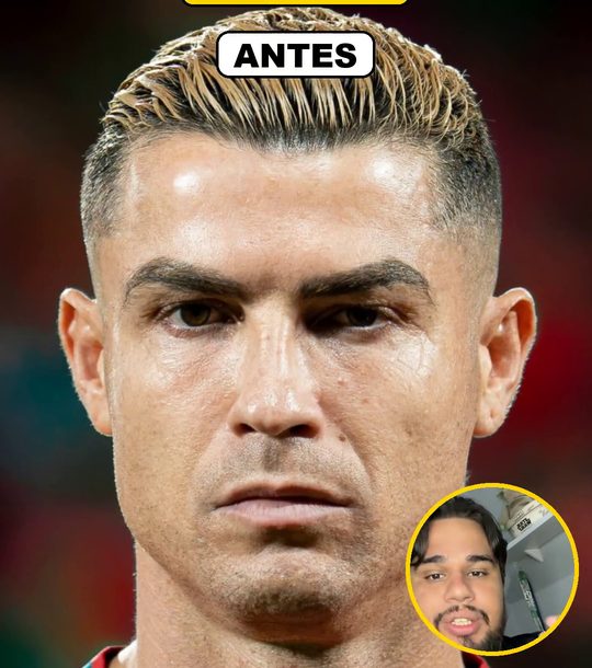 Antes do efeito Dourado